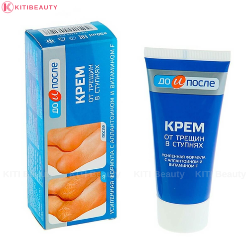 Kem Kpem Nga Trị Nứt Nẻ Gót Chân Apteka 50ml